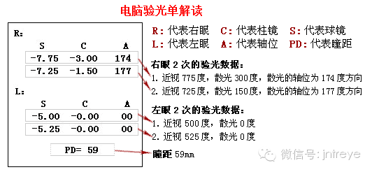 如何看懂验光单,教你涨姿势