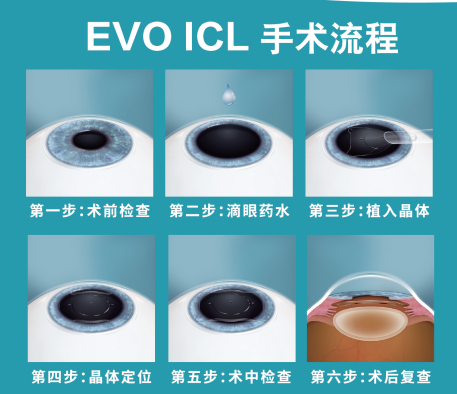 暑期摘镜总动员-近视矫正黑科技 ICL晶体知多少